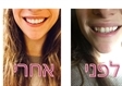 יישור שיניים בירושלים